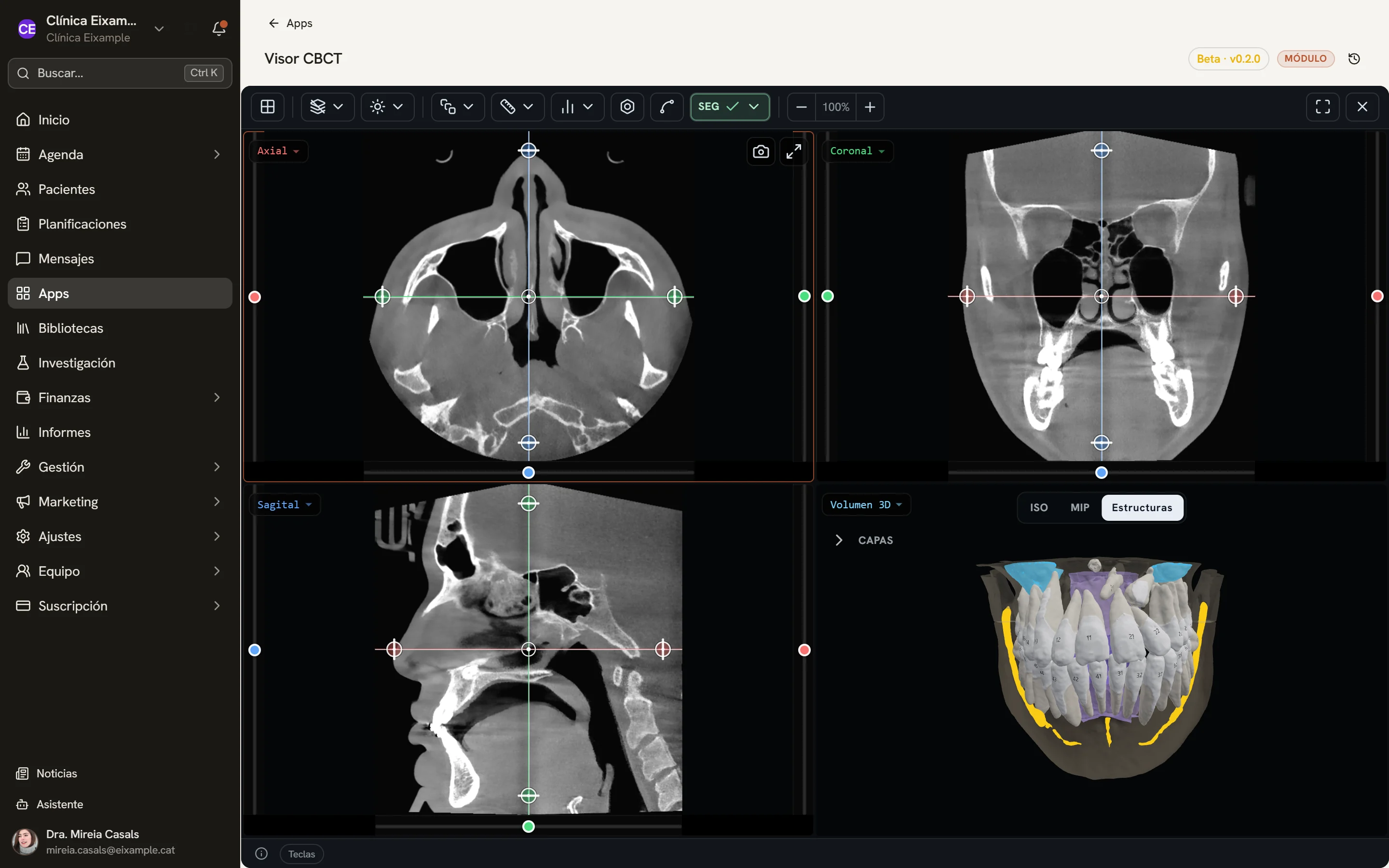 Visor de CBCT con los tres cortes y el volumen 3D de un estudio de muestra.