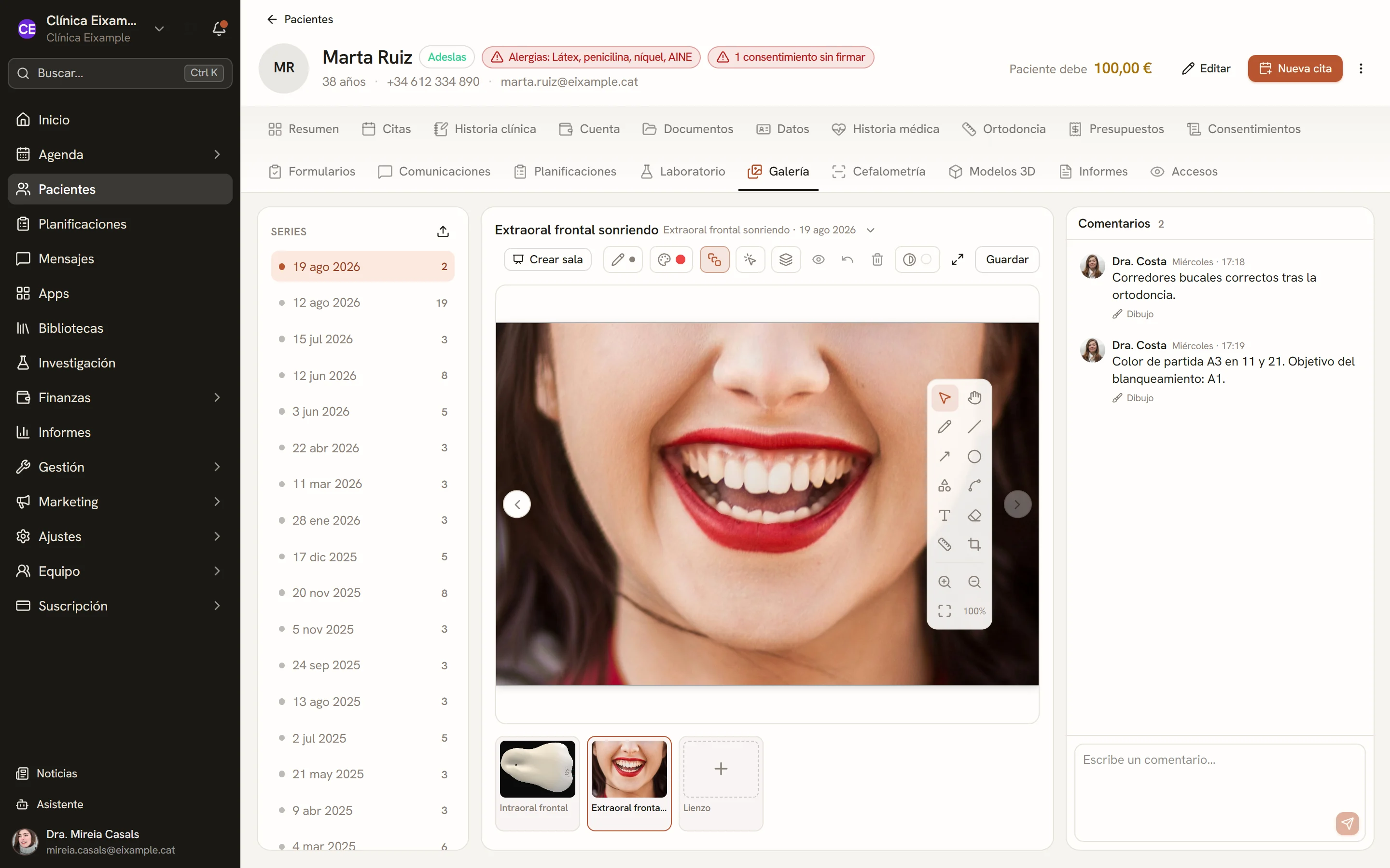 Editor de fotografías clínicas con anotaciones y comentarios sobre una foto de muestra.